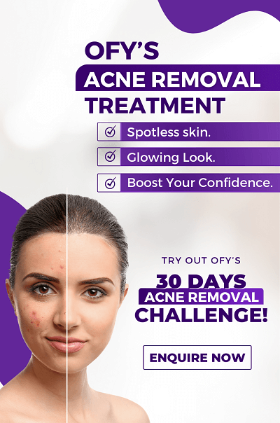 acne scar removal treatment fungal infection dry lightening allergy whitening oily laser brightening best skin clinic in india