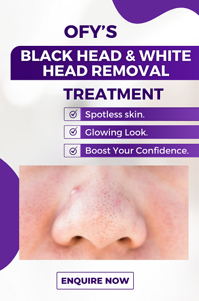 black head white head removal treatment skin lightening tightening ofy clinics best dermatologists in india.png