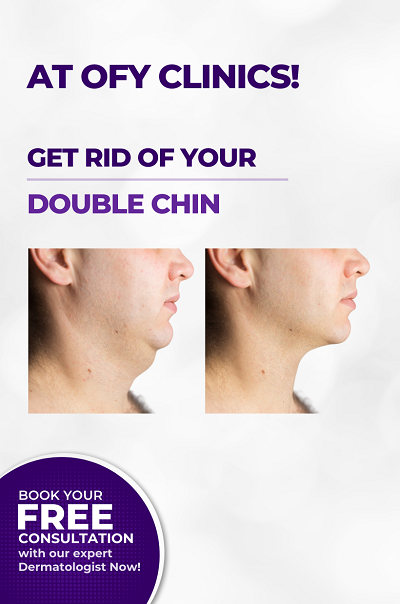 double chin reduction treatment laser non surgical best dermatologists india ofy clinics