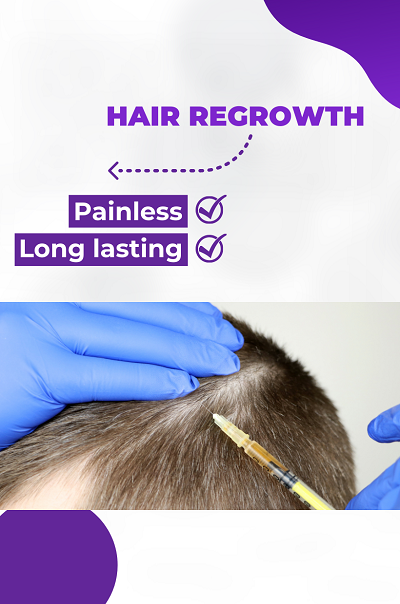 Hair Restoration Treatment - OFY