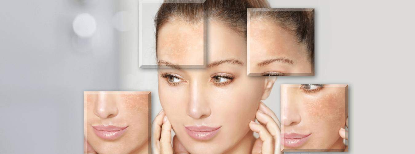 skin lightening treatment clinics dermatologist in india
