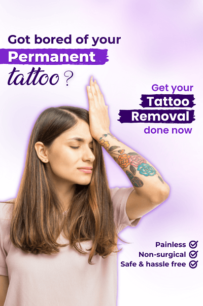 Tattoo Removal Treatment - OFY