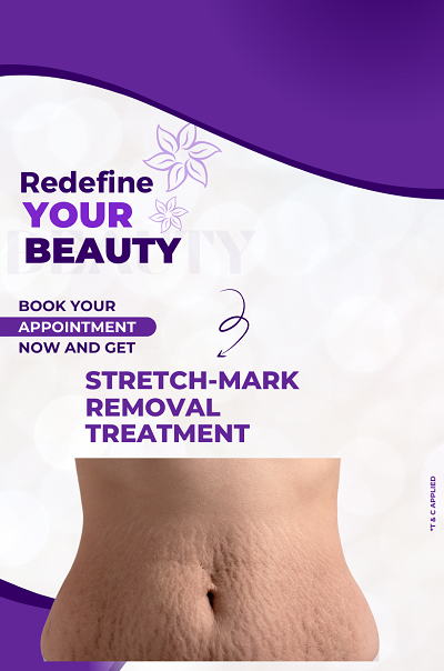 stretch-mark-removal-treatment-skin-treatment-best-dermatologists-india-ofy-clinics