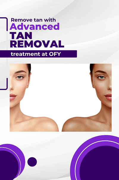 tan-removal-skin-treatment-whitening-lightning-treatment-clinics-dermatologist-in-india